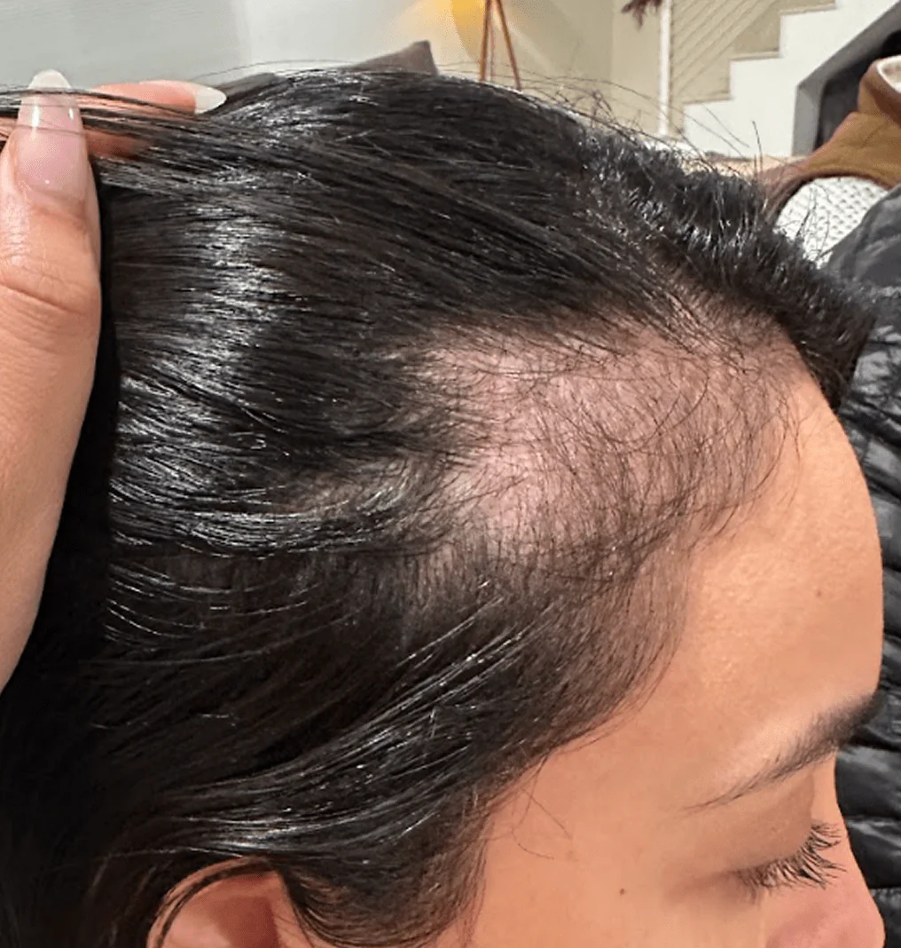 Unleash Your Hair's Natural Growth